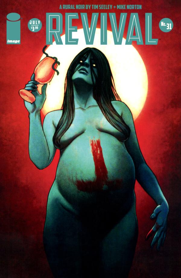 #31