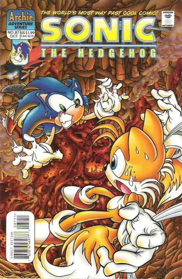 #87
