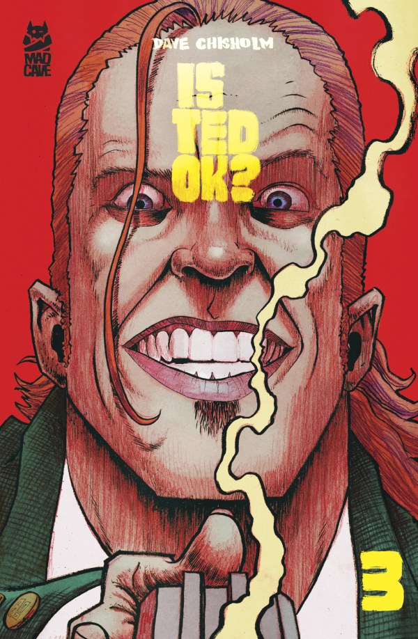 #3