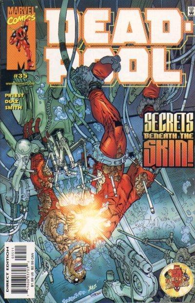 #35