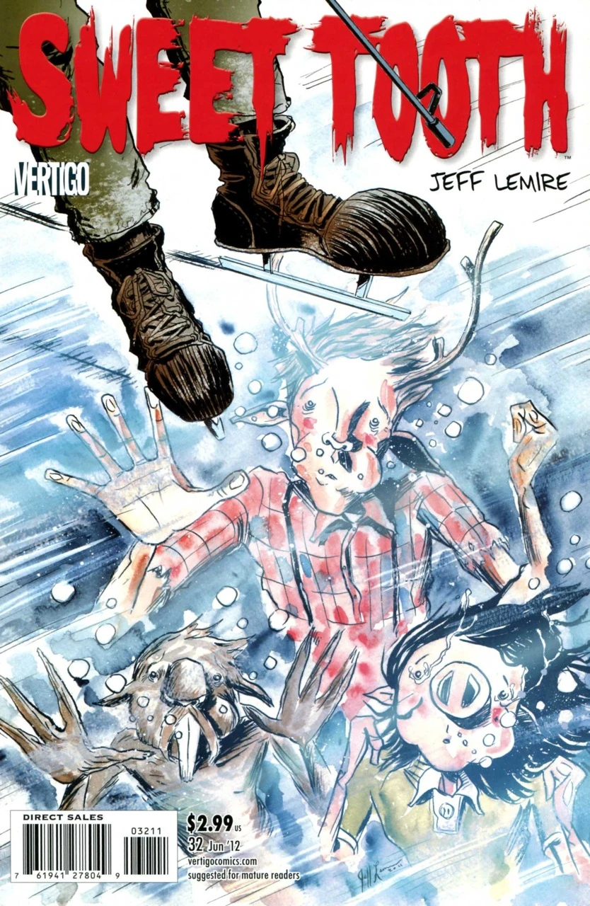 #32