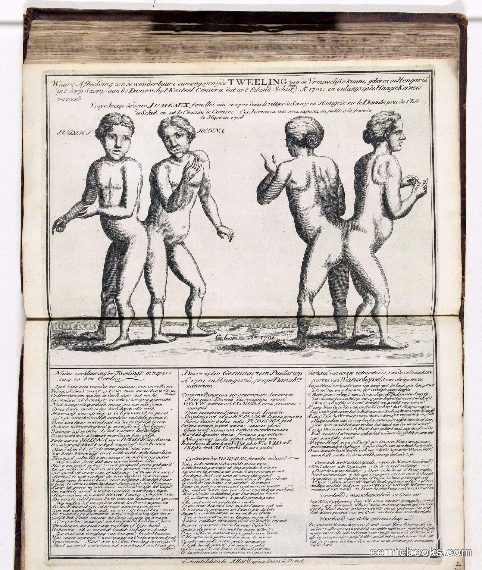 Siamese Twins from Hungary
