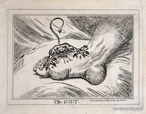 The Gout