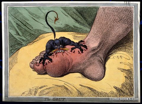 The Gout