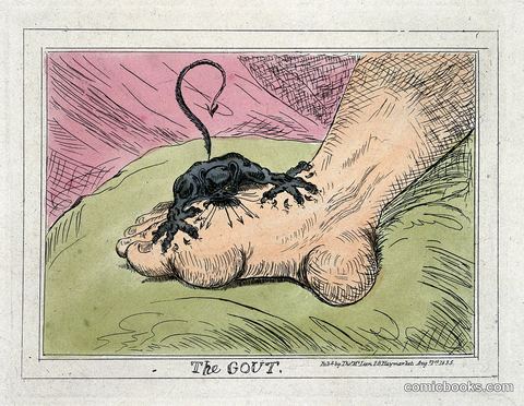 The Gout